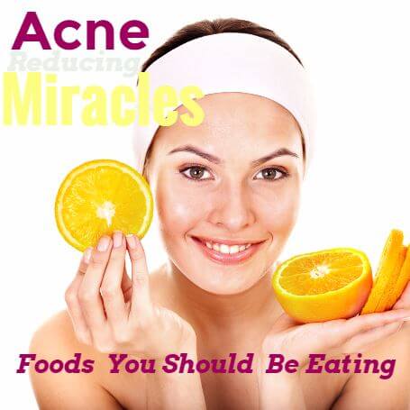Jan15BlogImageAcnePreventingFoods