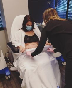 how does coolsculpting feel