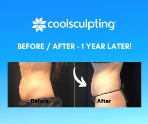 How does coolsculpting feel