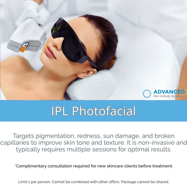 IPL 3pk
