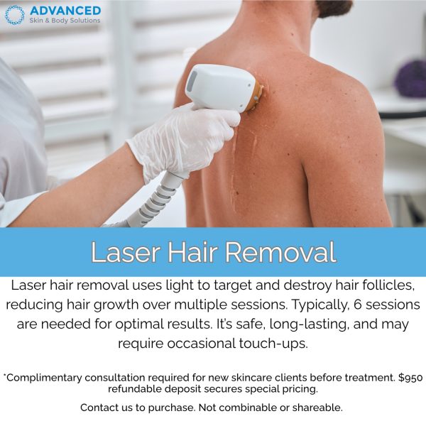 Laser Hair Removal  Buy 1 Area Package, Get 2nd Area 50% OFF (Equal or lesser value)