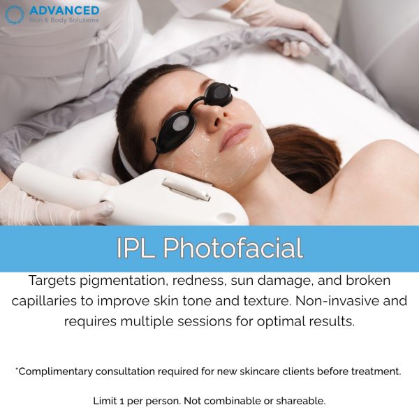 IPL Photofacial Buy 3 IPL Full Face, Get 1 FREE $1,800 — save $600